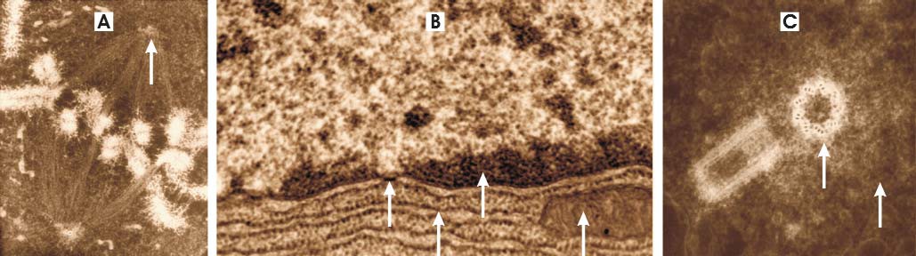 Micrografías actividad 3