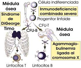 Inmunodeficiencias