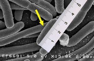 Escherichia coli