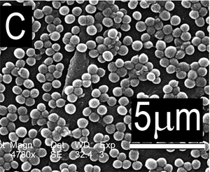 Staphylococcus aureus