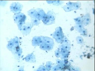 Células de descamación de mucosa bucal