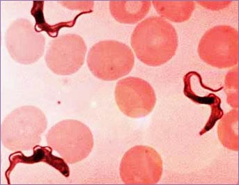 Trypanosoma brucei