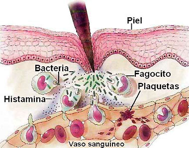 Respuesta inflamatoria