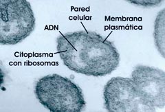 Neisseria gonorrhoeae